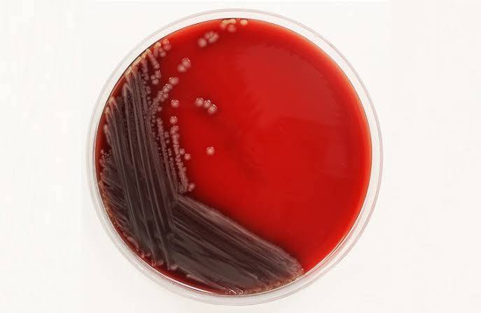محیط کشت آماده بلاد آگار *Blood agar*