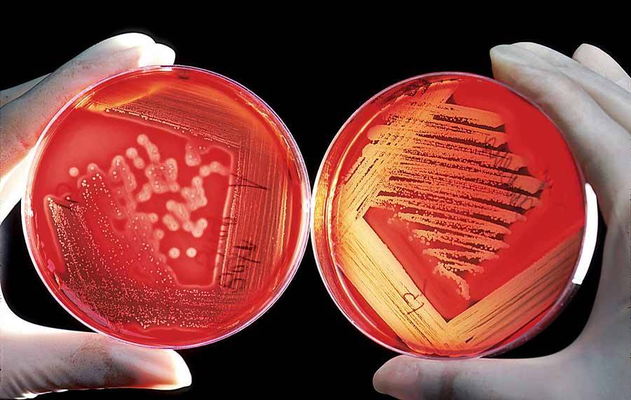 محیط کشت آماده بلاد آگار *Blood agar*