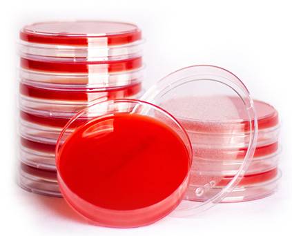 محیط کشت آماده بلاد آگار *Blood agar*
