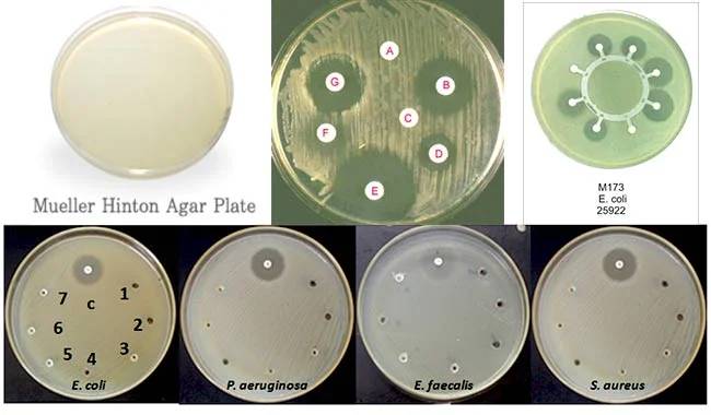 محیط کشت مولر هینتون / mueller hinton agar