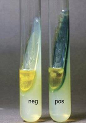 محیط کشت فنیل آلانین / phenylalanine agar