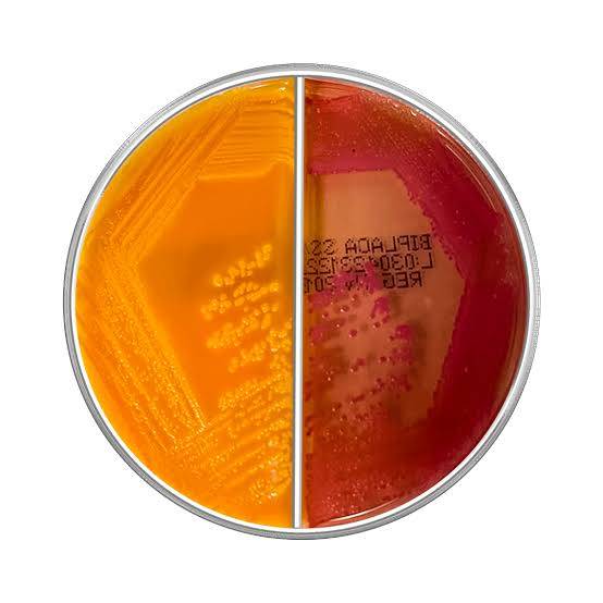 محیط کشت ترکیبی XLD / Hektoen Enteric Agar (دو محیط در یک پلیت) 8cm
