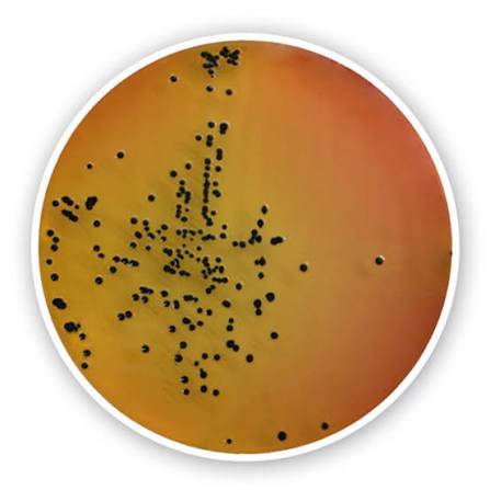 محیط کشت SS Agar (سالمونلا -شیگلا)